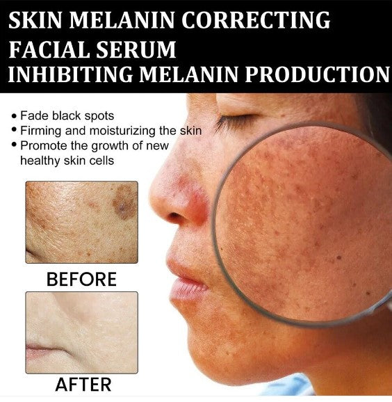 Gyors sötét foltokat eltávolító arcszérum a melanin korrekciójához