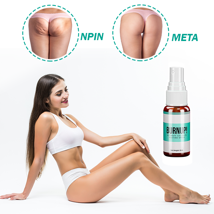 đżNövĂ©nyi anticellulit spray-k feszesĂtĆ Ă©s karcsĂșsĂtĂłđż