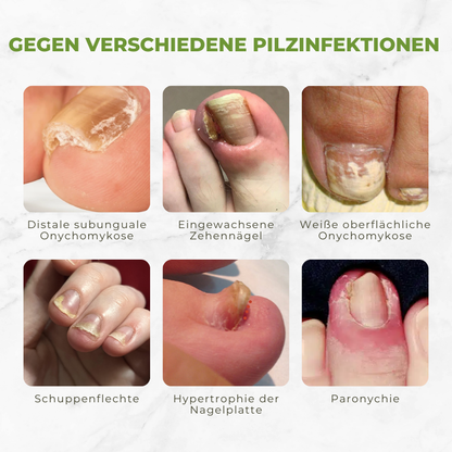 Körömkezelő olaj méhméreggel