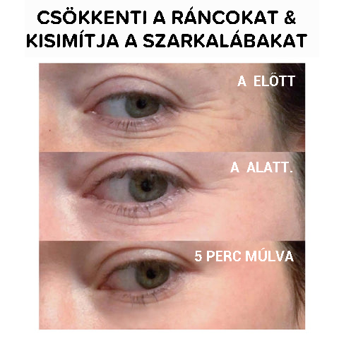 Azonnali szemfeszesítő krém